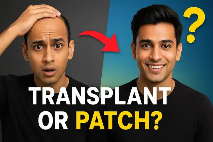 “Why Hair Patches Beat Hair Transplants for 20-Year-Olds in India”