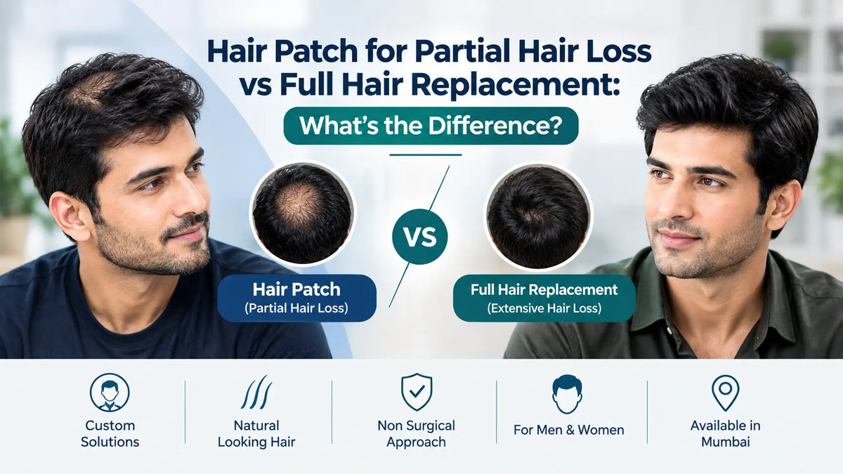 Hair Patch for Partial Hair Loss vs Full Hair Replacement: What's the Difference?