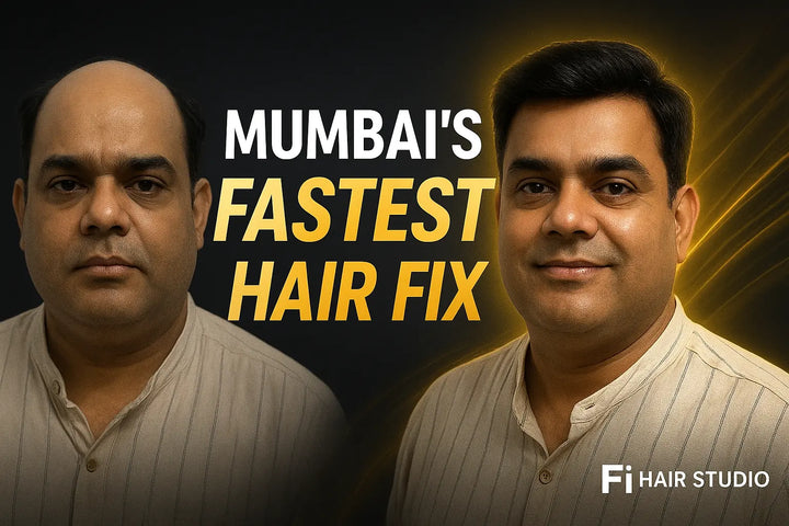 Mumbai’s Fastest Hair Loss Fix: Inside the World of Customized Hair Patches