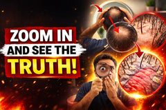 Think Your Bald Spot Is Small? Zoom In Once and See the Truth