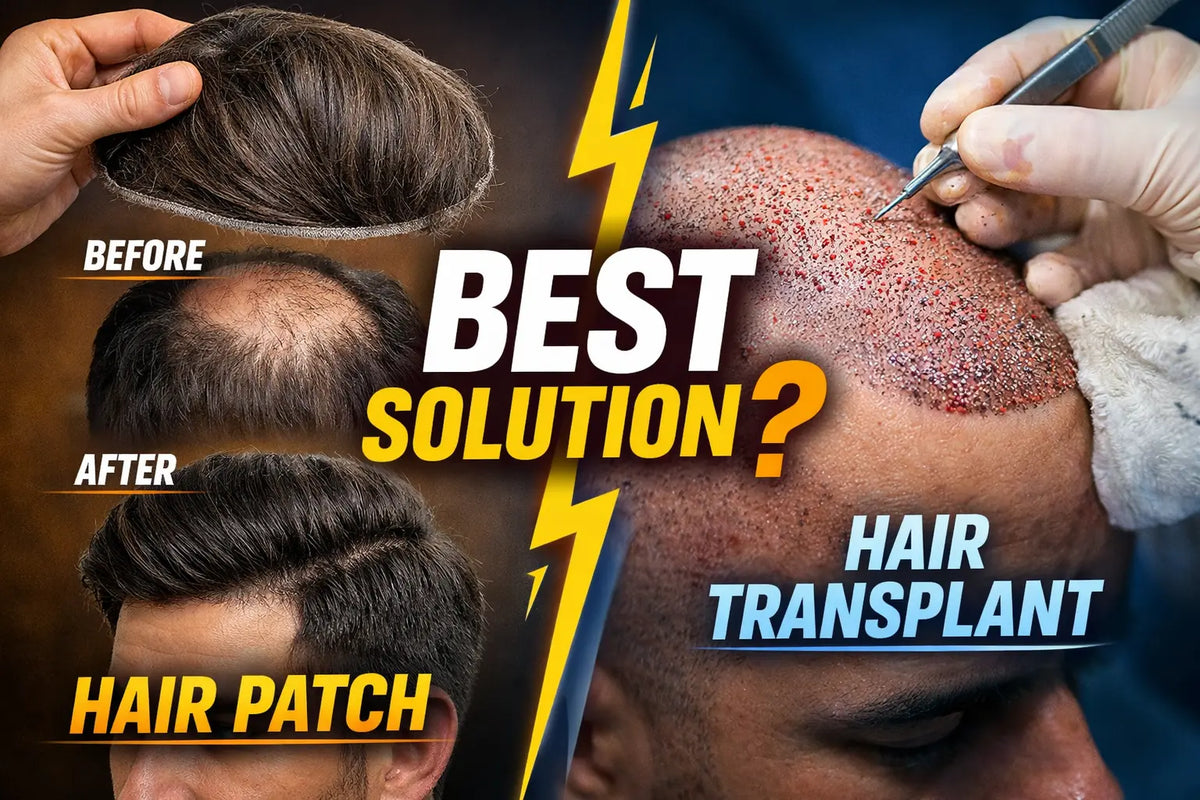 Hair Patch vs Hair Transplant After 30 What Works Best?