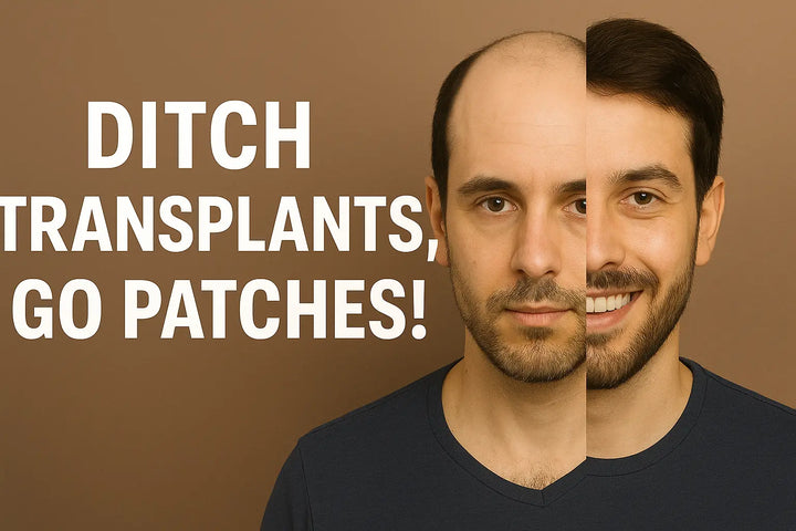 Why 23-Year-Old Guys Are Choosing Hair Patches Over Transplants